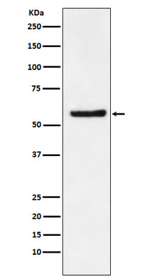 Anti-DKC1 Rabbit Monoclonal Antibody Boster Bio