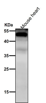 Anti-NFIB / NF1B2 Rabbit Monoclonal Antibody Boster Bio