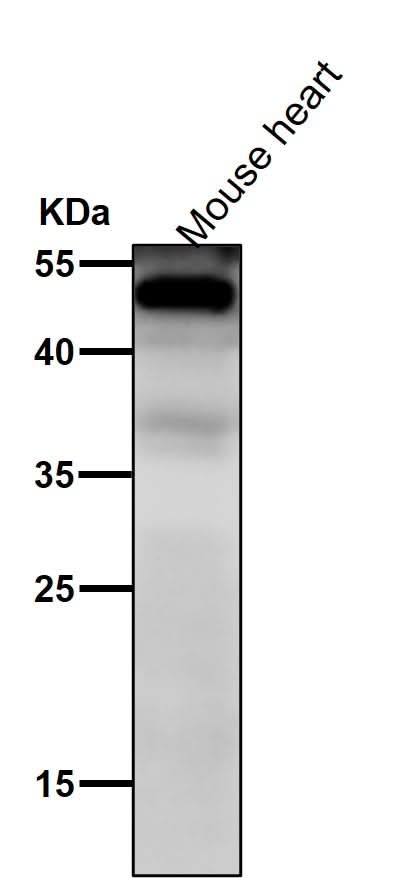 Anti-NFIB / NF1B2 Rabbit Monoclonal Antibody Boster Bio