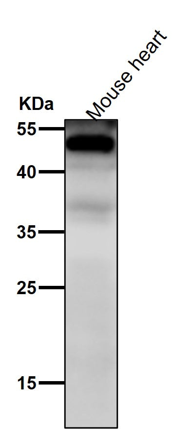 Anti-NFIB / NF1B2 Rabbit Monoclonal Antibody Boster Bio