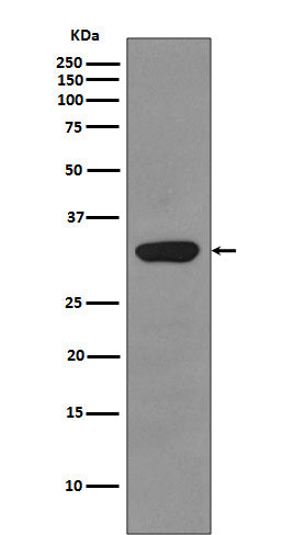 Anti-RPS3/Ribosomal Protein S3 Rabbit Monoclonal Antibody Boster Bio