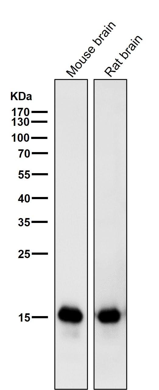 Anti-MAP1LC3A/Lc3A Rabbit Monoclonal Antibody Boster Bio