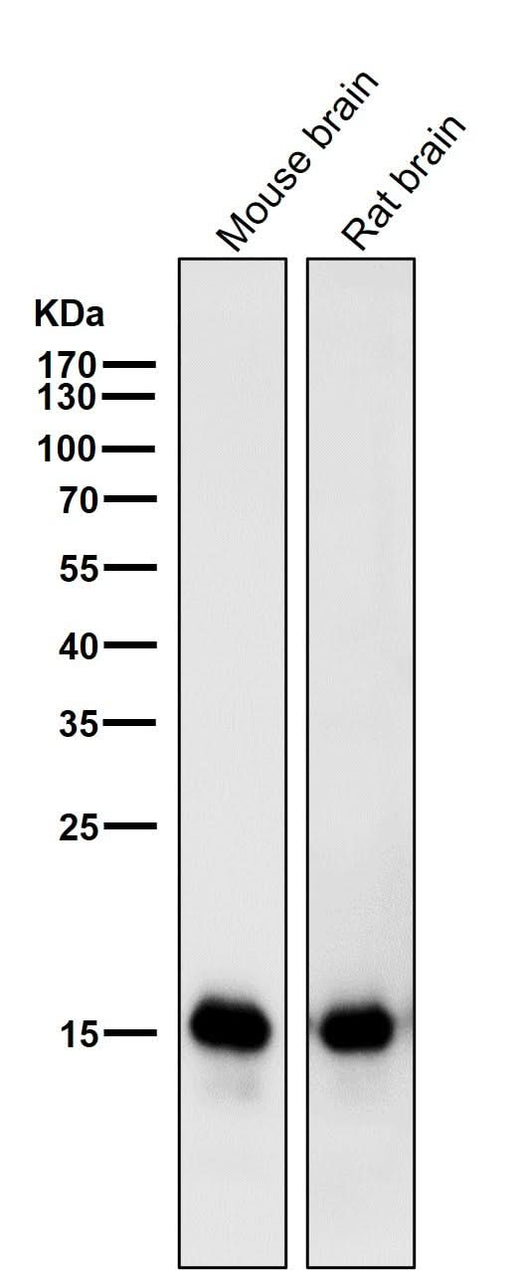 Anti-MAP1LC3A/Lc3A Rabbit Monoclonal Antibody Boster Bio