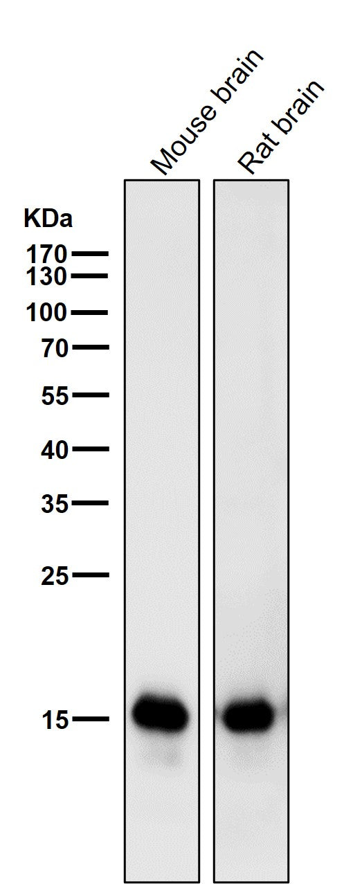 Anti-MAP1LC3A/Lc3A Rabbit Monoclonal Antibody Boster Bio