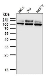 Anti-GAA Rabbit Monoclonal Antibody Boster Bio