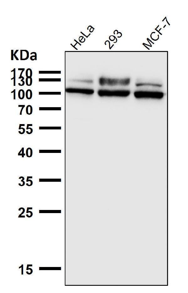 Anti-GAA Rabbit Monoclonal Antibody Boster Bio