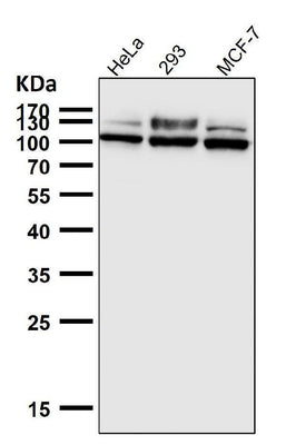 Anti-GAA Rabbit Monoclonal Antibody Boster Bio