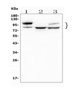 Anti-GAA Antibody Picoband® (monoclonal, 2G7 Boster Bio
