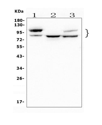 Anti-GAA Antibody Picoband® (monoclonal, 2G7 Boster Bio