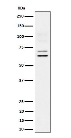Anti-BIN1 Rabbit Monoclonal Antibody Boster Bio