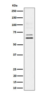 Anti-BIN1 Rabbit Monoclonal Antibody Boster Bio