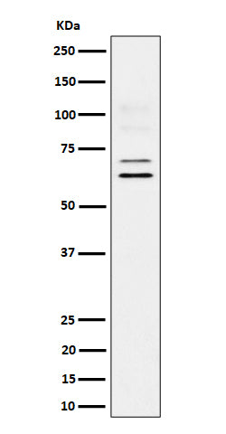 Anti-BIN1 Rabbit Monoclonal Antibody Boster Bio