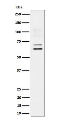 Anti-BIN1 Rabbit Monoclonal Antibody Boster Bio