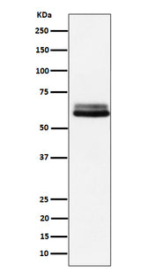 Anti-BIN1 Rabbit Monoclonal Antibody Boster Bio