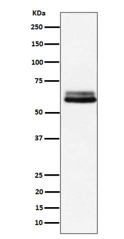 Anti-BIN1 Rabbit Monoclonal Antibody Boster Bio