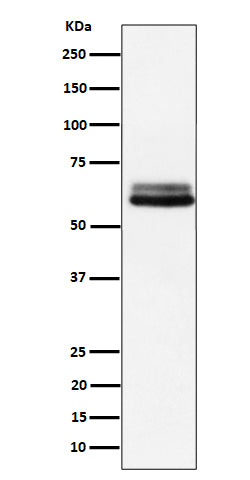 Anti-BIN1 Rabbit Monoclonal Antibody Boster Bio