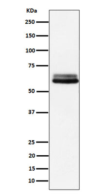 Anti-BIN1 Rabbit Monoclonal Antibody Boster Bio