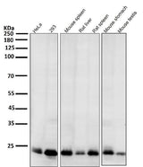 Anti-Bim BCL2L11 Rabbit Monoclonal Antibody Boster Bio