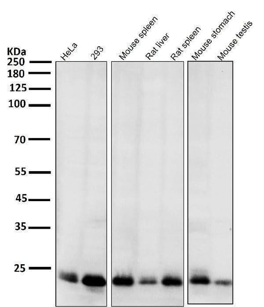 Anti-Bim BCL2L11 Rabbit Monoclonal Antibody Boster Bio