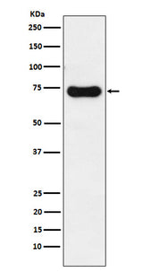 Anti-IRAK2 Rabbit Monoclonal Antibody Boster Bio