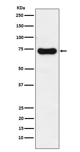Anti-IRAK2 Rabbit Monoclonal Antibody Boster Bio