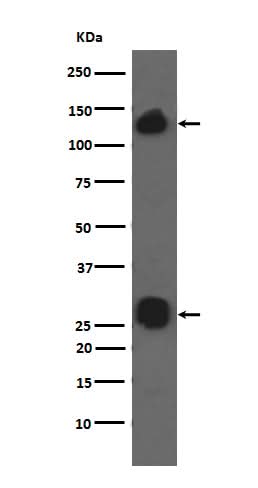 Anti-Integrin alpha V ITGAV Rabbit Monoclonal Antibody Boster Bio