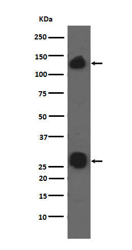 Anti-Integrin alpha V ITGAV Rabbit Monoclonal Antibody Boster Bio