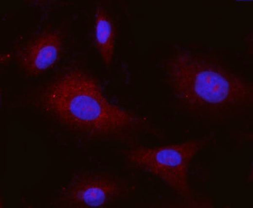 Anti-Integrin alpha V/ITGAV Antibody Picoband® (monoclonal, 8B10H2 Boster Bio