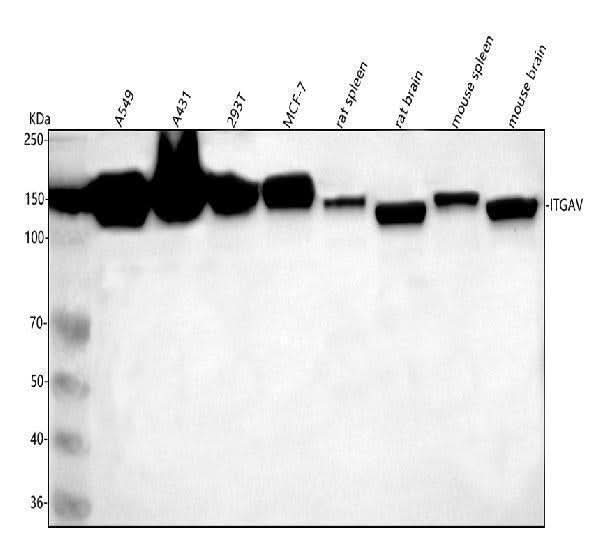 Anti-Integrin alpha V ITGAV Rabbit Monoclonal Antibody Boster Bio