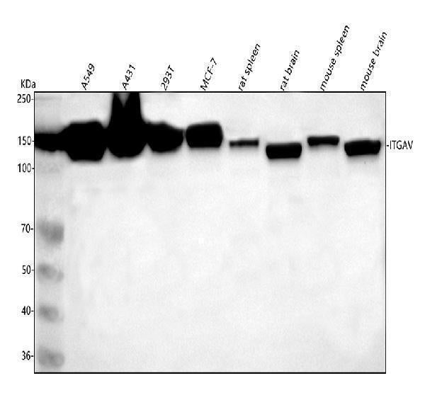 Anti-Integrin alpha V ITGAV Rabbit Monoclonal Antibody Boster Bio