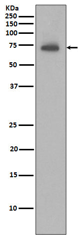 Anti-IAP2 BIRC3 Rabbit Monoclonal Antibody Boster Bio