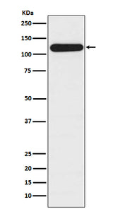 Anti-BubR1 BUB1B Rabbit Monoclonal Antibody Boster Bio