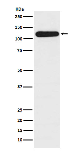 Anti-BubR1 BUB1B Rabbit Monoclonal Antibody Boster Bio