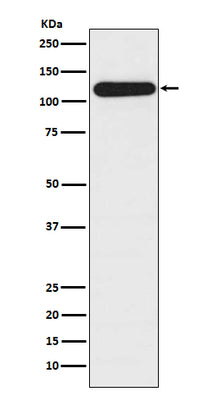 Anti-BubR1 BUB1B Rabbit Monoclonal Antibody Boster Bio