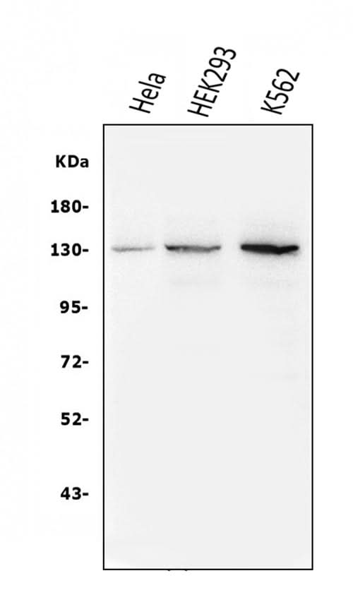 Anti-BubR1/BUB1B Antibody Picoband® (monoclonal, 5I7 Boster Bio