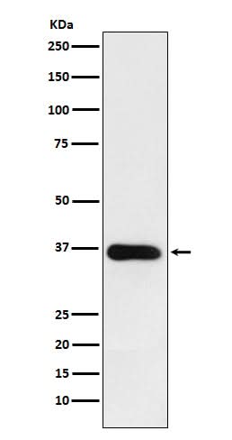 Anti-HSD11B1 Rabbit Monoclonal Antibody Boster Bio