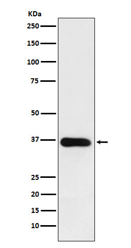 Anti-HSD11B1 Rabbit Monoclonal Antibody Boster Bio