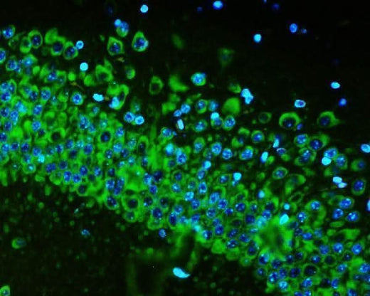 Anti-RPS6 Antibody Picoband® (monoclonal, 2H7 Boster Bio