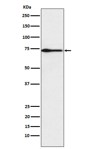 Anti-PROS1 Rabbit Monoclonal Antibody Boster Bio