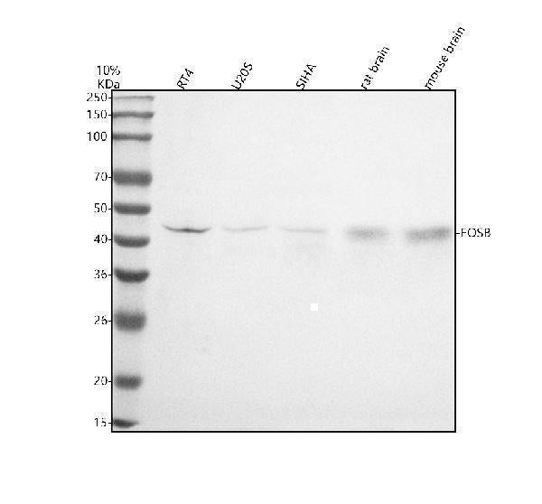 Anti-Fos B Rabbit Monoclonal Antibody Boster Bio