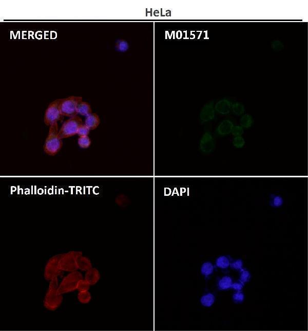 Anti-AIF AIFM1 Rabbit Monoclonal Antibody Boster Bio