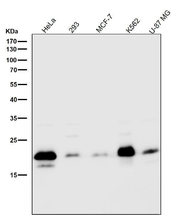 Anti-Caveolin-2 CAV2 Rabbit Monoclonal Antibody Boster Bio