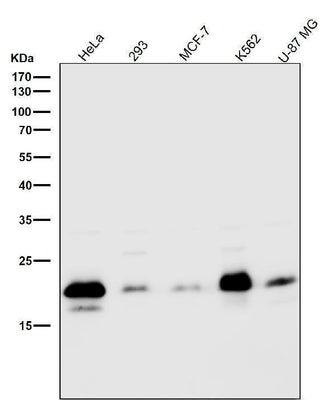 Anti-Caveolin-2 CAV2 Rabbit Monoclonal Antibody Boster Bio