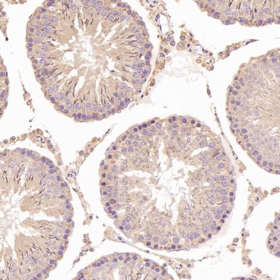 Anti-N-Cadherin-2 CDH2 CD325-Rabbit Monoclonal Antibody Boster Bio