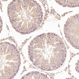 Anti-N-Cadherin-2 CDH2 CD325-Rabbit Monoclonal Antibody Boster Bio