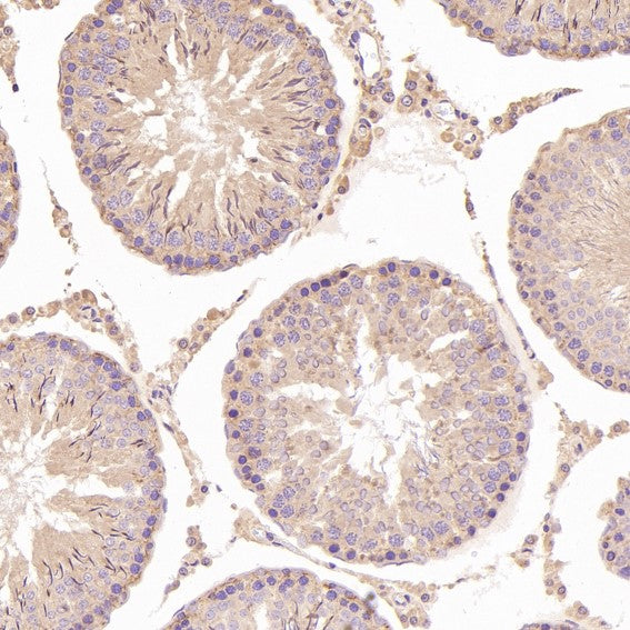 Anti-N-Cadherin-2 CDH2 CD325-Rabbit Monoclonal Antibody Boster Bio