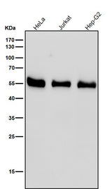 Anti-RAD52 Rabbit Monoclonal Antibody Boster Bio