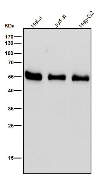 Anti-RAD52 Rabbit Monoclonal Antibody Boster Bio