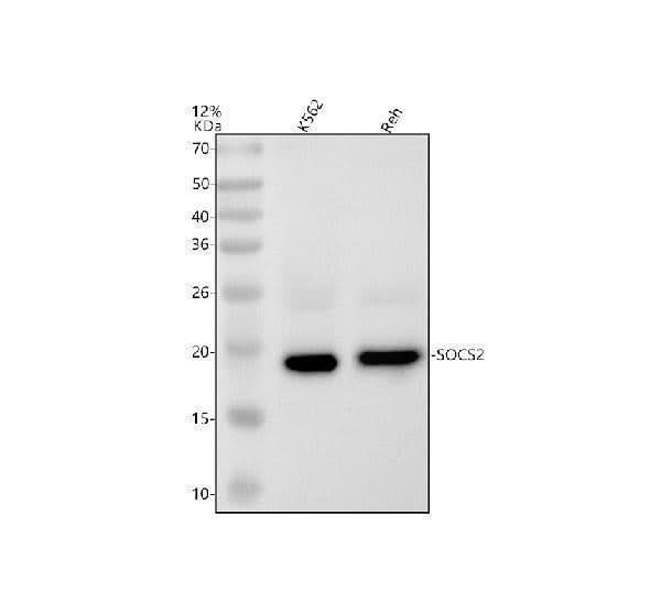 Anti-SOCS2 Rabbit Monoclonal Antibody Boster Bio