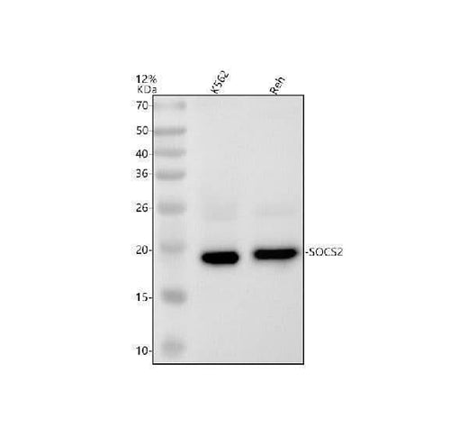 Anti-SOCS2 Rabbit Monoclonal Antibody Boster Bio
